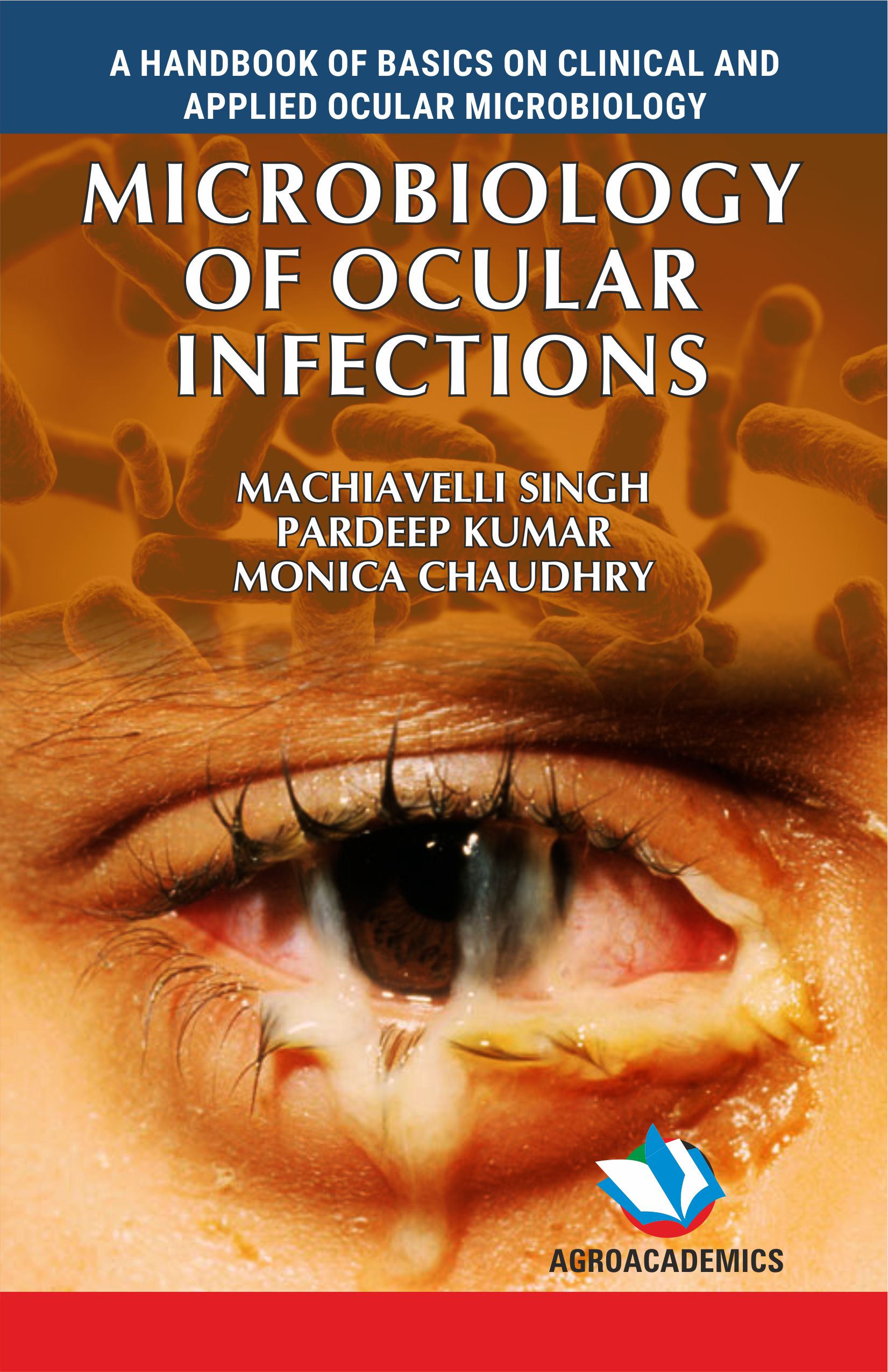 Microbiology of Ocular Infections