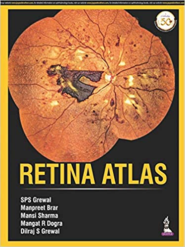 Retina Atlas